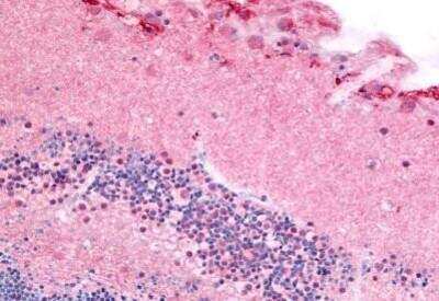 Immunohistochemistry-Paraffin: PDE6A Antibody [NB110-40461]