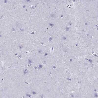 Immunohistochemistry-Paraffin: PDE6A Antibody [NBP1-87312]