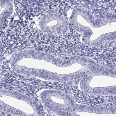 Immunohistochemistry-Paraffin: PDE6A Antibody [NBP1-87312]