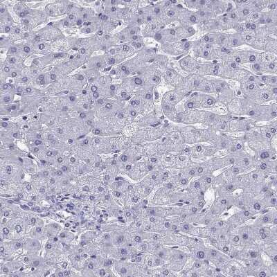 Immunohistochemistry-Paraffin: PDE6A Antibody [NBP1-87312]