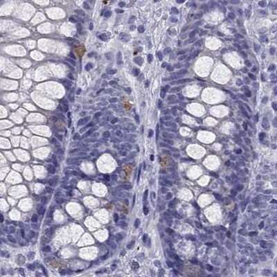 Immunohistochemistry-Paraffin: PDE6A Antibody [NBP2-68985]
