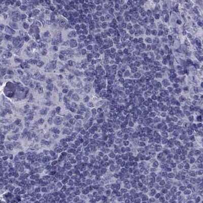 Immunohistochemistry-Paraffin: PDE6A Antibody [NBP2-68985]
