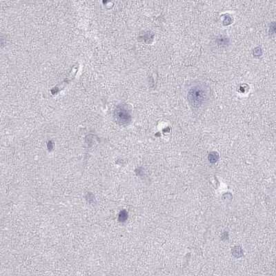 Immunohistochemistry-Paraffin: PDE6A Antibody [NBP2-68985]