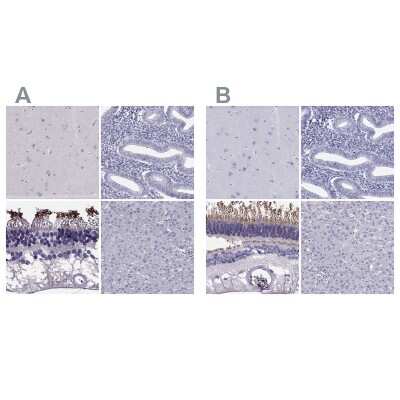 Immunohistochemistry-Paraffin: PDE6A Antibody [NBP2-68985]