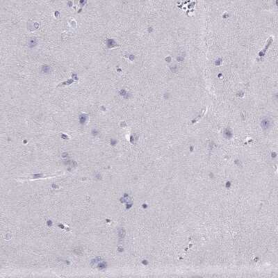 Immunohistochemistry-Paraffin: PDE6A Antibody [NBP2-68985]
