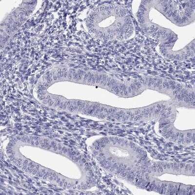 Immunohistochemistry-Paraffin: PDE6A Antibody [NBP2-68985]