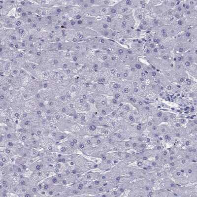 Immunohistochemistry-Paraffin: PDE6A Antibody [NBP2-68985]
