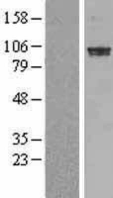 Western Blot: PDE6A Overexpression Lysate [NBL1-14226]