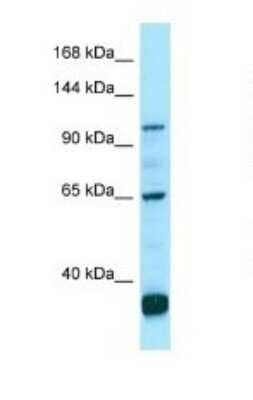 Western Blot: PDE6C Antibody [NBP1-98502]