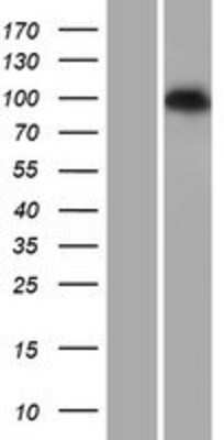 Western Blot: PDE6C Overexpression Lysate [NBP2-07653]