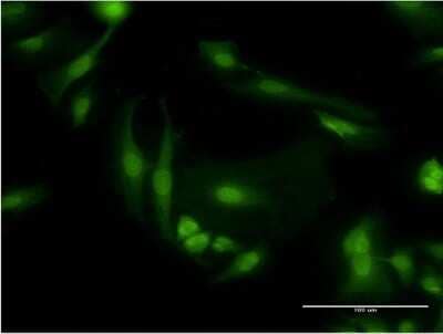 Immunocytochemistry/ Immunofluorescence: PDE6D Antibody (4H6) [H00005147-M05]