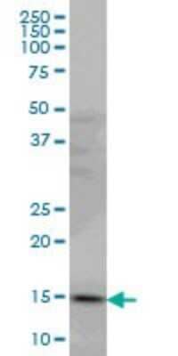 Western Blot: PDE6D Antibody (5C7) [H00005147-M06]