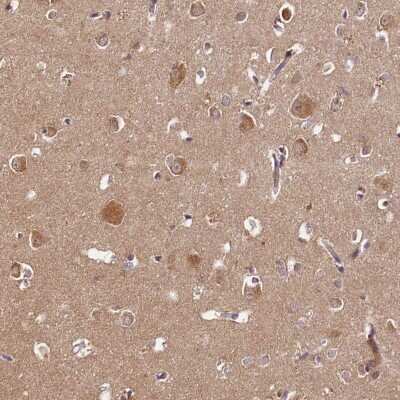 Immunohistochemistry-Paraffin: PDE6D Antibody [NBP1-86275]