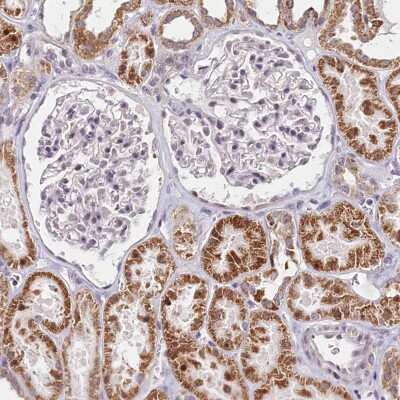 Immunohistochemistry-Paraffin: PDE6D Antibody [NBP1-86275]