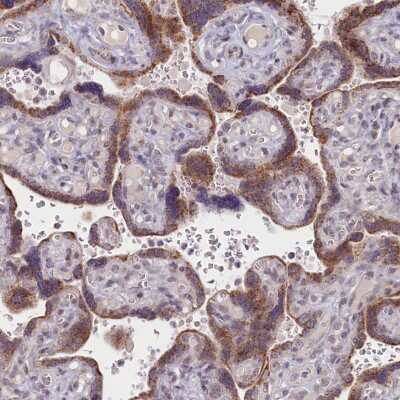 Immunohistochemistry-Paraffin: PDE6D Antibody [NBP1-86275]