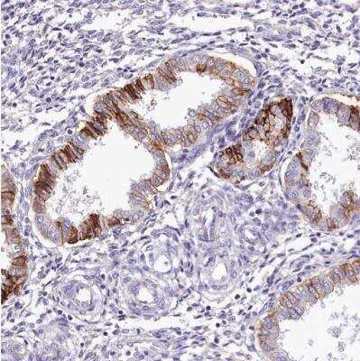 Immunohistochemistry-Paraffin: PDE6D Antibody [NBP2-38346]