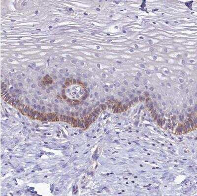 Immunohistochemistry-Paraffin: PDE6D Antibody [NBP2-38346]