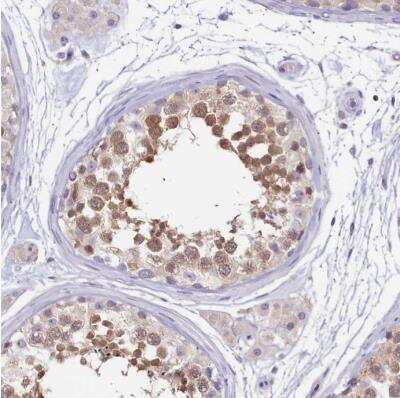 Immunohistochemistry-Paraffin: PDE6D Antibody [NBP2-38346]