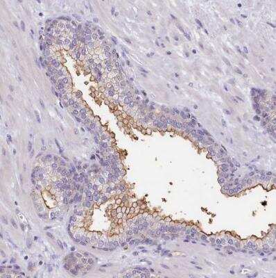 Immunohistochemistry-Paraffin: PDE6D Antibody [NBP2-38346]