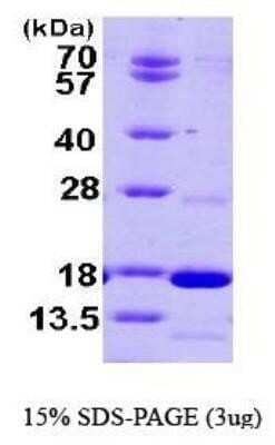 SDS-PAGE: Recombinant Human PDE6D His Protein [NBP1-44480]