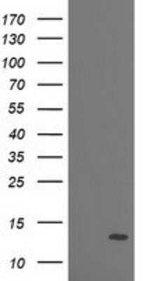 Western Blot: PDE6G Antibody (OTI2F5) [NBP2-01353]