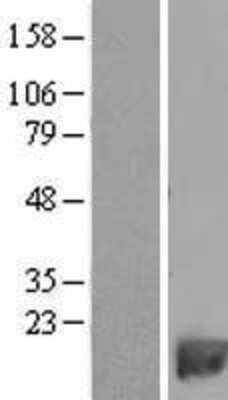 Western Blot: PDE6H Overexpression Lysate [NBL1-14229]