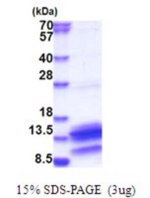 SDS-PAGE: Recombinant Human PDE6H His Protein [NBP2-51798]