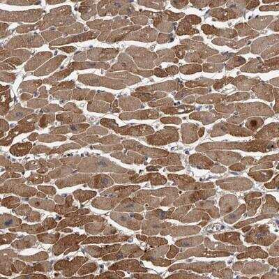 Immunohistochemistry-Paraffin: PDE7A Antibody [NBP1-83275]