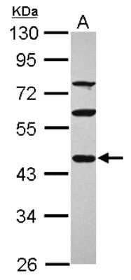 Western Blot: PDE7A Antibody [NBP2-19747]