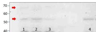 Western Blot: PDE7A Antibody [NBP3-12445]