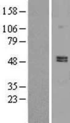 Western Blot: PDE7A Overexpression Lysate [NBL1-14230]