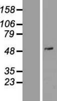 Western Blot: PDE7A Overexpression Lysate [NBP2-08091]