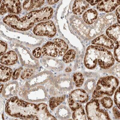Immunohistochemistry-Paraffin: PDE7B Antibody [NBP1-85987]
