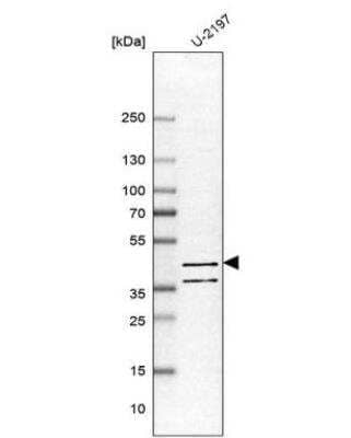 Western Blot: PDE7B Antibody [NBP1-85987]