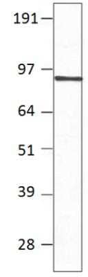 Western Blot: PDE7B Antibody [NBP3-12246]