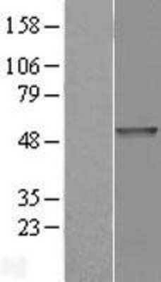 Western Blot: PDE7B Overexpression Lysate [NBL1-14231]