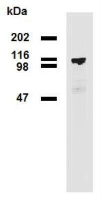 Western Blot: PDE8A Antibody (EM-52) [NBP2-62213]