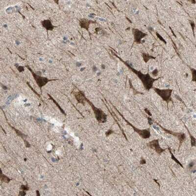 Immunohistochemistry-Paraffin: PDE8A Antibody [NBP1-83160]