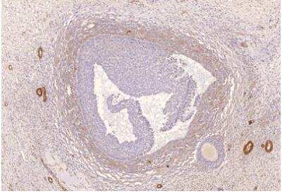 Immunohistochemistry-Paraffin: PDE8A Antibody [NBP3-12247]