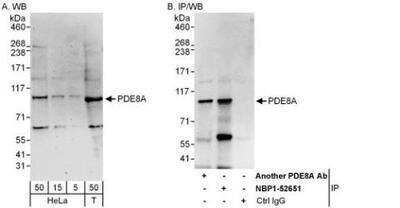 Western Blot: PDE8A Antibody [NBP1-52651]