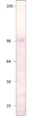 Western Blot: PDE8A Antibody [NBP3-12247]