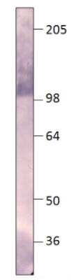 Western Blot: PDE8A Antibody [NBP3-12247]