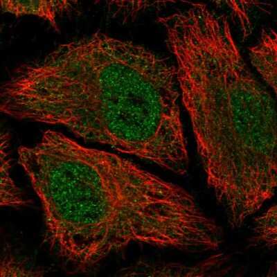 Immunocytochemistry/ Immunofluorescence: PDE8B Antibody [NBP2-58096]