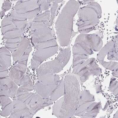 Immunohistochemistry-Paraffin: PDE8B Antibody [NBP1-86280]