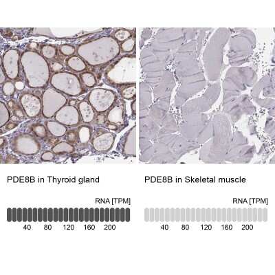 Immunohistochemistry-Paraffin: PDE8B Antibody [NBP1-86280]