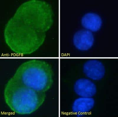 Immunocytochemistry/ Immunofluorescence: PDGF-B Antibody [NBP1-52533]