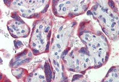 Immunohistochemistry-Paraffin: PDGF-B Antibody [NBP1-52533]