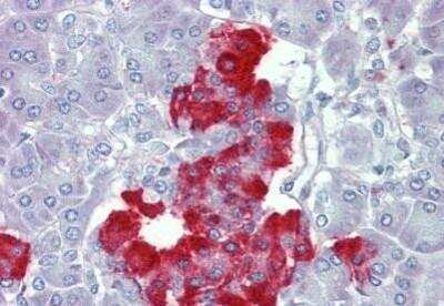 Immunohistochemistry-Paraffin: PDGF-B Antibody [NBP1-52533]