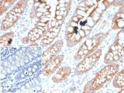 Immunohistochemistry-Paraffin: PDGF-B Antibody (PDGFB/3071) [NBP3-07810]