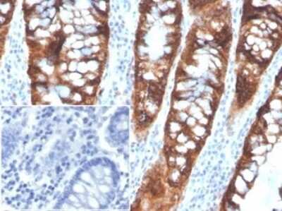 Immunohistochemistry-Paraffin: PDGF-B Antibody (PDGFB/3072) [NBP3-07811]